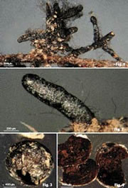 Colour plate of ectomycorrhizal root tips of Cenococcum geophilium on Picea engelmannii